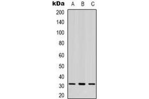 Western blot analysis of CBR3 expression in K562 (A), MCF7 (B), Hela (C) whole cell lysates.
