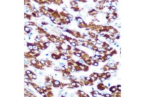 Immunohistochemistry of paraffin-embedded human liver using SERPINC1 Rabbit mAb (ABIN7270208) at dilution of 1:100 (40x lens).