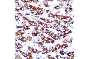 Immunohistochemistry of paraffin-embedded human liver using SERPINC1 Rabbit mAb (ABIN7270208) at dilution of 1:100 (40x lens). (SERPINC1 anticorps)