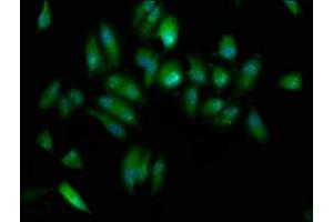 Immunofluorescence staining of Hela cells with ABIN7151580 at 1:133, counter-stained with DAPI. (ELP3/KAT9 anticorps  (AA 1-85))
