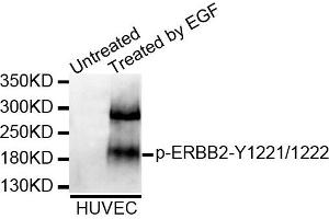 Western blot analysis of extracts of HUVEC cell line, using Phospho-ERBB2-Y1221/1222 antibody. (ErbB2/Her2 anticorps  (pTyr1221, pTyr1222))