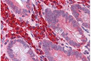 Human Small Intestine: Formalin-Fixed, Paraffin-Embedded (FFPE)