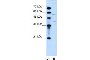 WB Suggested Anti-DHODH Antibody Titration:  2. (DHODH anticorps  (N-Term))