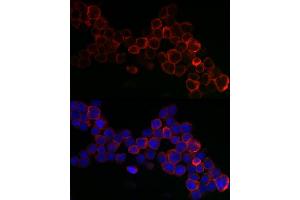 Immunofluorescence analysis of THP-1 cells using GPX1 antibody (ABIN3021455, ABIN3021456, ABIN3021457, ABIN1512957 and ABIN6215063) at dilution of 1:200.