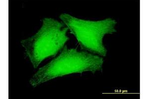 Immunofluorescence of purified MaxPab antibody to RPUSD3 on HeLa cell. (RPUSD3 anticorps  (AA 1-343))
