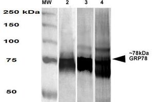 Western Blot analysis of Human, Mouse, Rat HEK-293, NIH3T3, and Rat Brain cell lysates showing detection of GRP78 protein using Mouse Anti-GRP78 Monoclonal Antibody, Clone 3G12-1G11 . (GRP78 anticorps  (PE))