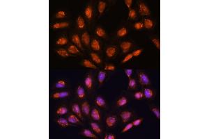 Immunofluorescence analysis of U-2 OS cells using TIMM44 antibody (ABIN7270927) at dilution of 1:100.