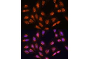 Immunofluorescence analysis of U-2 OS cells using TIMM44 antibody (ABIN7270927) at dilution of 1:100. (TIMM44 anticorps  (AA 153-452))