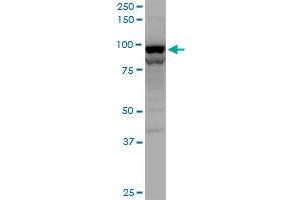 TNPO2 polyclonal antibody (A01), Lot # 060619JCS1. (TNPO2 anticorps  (AA 201-300))