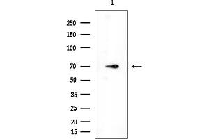 Western blot analysis of lysates from Mouse testis, using RIPK1 Mouse Monoclonal Antibody at 1/1000 dilution.