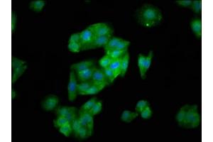 Immunofluorescence staining of HepG2 cells with ABIN7170211 at 1:133, counter-stained with DAPI. (SLC26A6 anticorps  (AA 554-668))