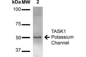Western Blot analysis of Rat Brain Membrane showing detection of ~50 kDa TASK1 Potassium Channel protein using Mouse Anti-TASK1 Potassium Channel Monoclonal Antibody, Clone S374-48 . (KCNK3 anticorps  (AA 251-411) (FITC))