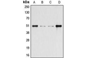 Western blot analysis of Beta-arrestin-1 (pS412) expression in HeLa (A), HEK293T (B), Raw264. (beta Arrestin 1 anticorps  (C-Term, pSer412))