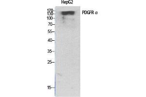 Western Blot (WB) analysis of specific cells using PDGFR-alpha Polyclonal Antibody. (PDGFRA anticorps  (C-Term))