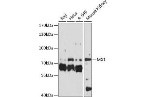 Western blot analysis of extracts of various cell lines, using MX1 antibody (ABIN3022532, ABIN3022533, ABIN3022534 and ABIN6218886) at 1:3000 dilution. (MX1 anticorps  (AA 368-662))
