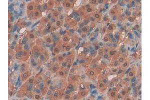 DAB staining on IHC-P; Samples: Rat Intestine Tissue (KIT Ligand anticorps  (AA 27-259))