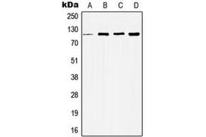 Western blot analysis of Histone Deacetylase 5 expression in MCF7 (A), HeLa (B), NIH3T3 (C), H9C2 (D) whole cell lysates. (HDAC5 anticorps  (Center))