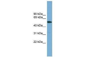 TMPRSS4 antibody used at 1 ug/ml to detect target protein. (TMPRSS4 anticorps  (Middle Region))