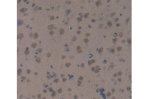 IHC-P analysis of brain tissue, with DAB staining. (MAP1B anticorps  (AA 2203-2464))