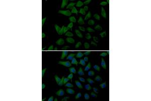 Immunofluorescence analysis of U2OS cells using PLOD2 antibody (ABIN5974174). (PLOD2 anticorps)