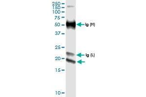 Immunoprecipitation of IFNE transfected lysate using anti-IFNE MaxPab rabbit polyclonal antibody and Protein A Magnetic Bead , and immunoblotted with IFNE MaxPab rabbit polyclonal antibody (D01) . (IFNE anticorps  (AA 1-208))