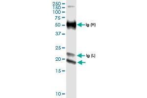 Immunoprecipitation of IFNE transfected lysate using anti-IFNE MaxPab rabbit polyclonal antibody and Protein A Magnetic Bead , and immunoblotted with IFNE MaxPab rabbit polyclonal antibody (D01) . (IFNE anticorps  (AA 1-208))