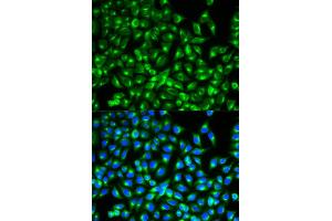 Immunofluorescence analysis of MCF-7 cells using CDC34 antibody. (CDC34 anticorps)