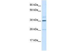 WB Suggested Anti-LASS3 Antibody Titration: 0. (LASS3 anticorps  (N-Term))