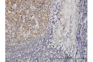 Immunoperoxidase of purified MaxPab antibody to VPREB3 on formalin-fixed paraffin-embedded human tonsil.