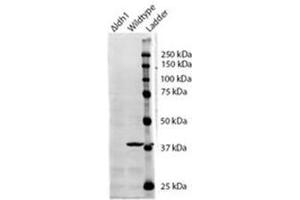 AP31099PU-N IDH1 antibody staining of S. (IDH1 anticorps  (Internal Region))