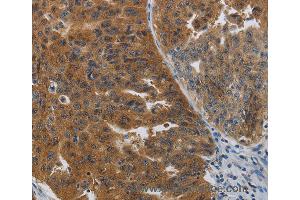 Immunohistochemistry of Human tonsil using PDCD2 Polyclonal Antibody at dilution of 1:50 (PDCD2 anticorps)