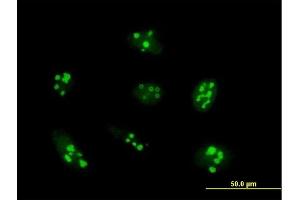 Immunofluorescence of purified MaxPab antibody to UTP14A on HeLa cell. (UTP14A anticorps  (AA 1-771))