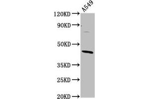 Western Blot Positive WB detected in: A549 whole cell lysate All lanes: ELMOD3 antibody at 4. (ELMOD3 anticorps  (AA 1-102))