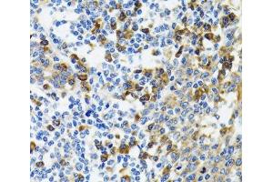 Immunohistochemistry of paraffin-embedded Human tonsil using HYOU1 Polyclonal Antibody at dilution of 1:100 (40x lens). (HYOU1 anticorps)