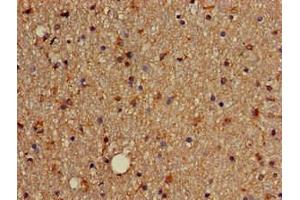 Immunohistochemistry of paraffin-embedded human brain tissue using ABIN7172631 at dilution of 1:100