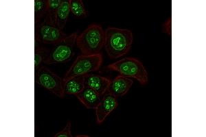 Immunofluorescent staining of HeLa cells. (Ki-67 anticorps  (AA 2293-2478))