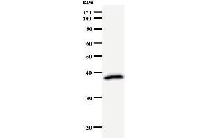 Western Blotting (WB) image for anti-RuvB-Like 1 (E. Coli) (RUVBL1) antibody (ABIN932457) (RUVBL1 anticorps)