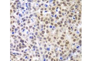 Immunohistochemistry of paraffin-embedded Mouse cancer using LHX4 Polyclonal Antibody at dilution of 1:100 (40x lens). (LHX4 anticorps)