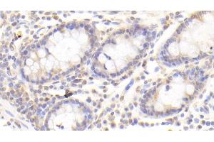 Detection of APPBP1 in Human Colon Tissue using Polyclonal Antibody to Amyloid Beta Precursor Protein Binding Protein 1 (APPBP1) (NAE1 anticorps  (AA 229-534))