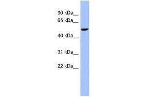 WB Suggested Anti-CBLL1 Antibody Titration:  0. (CBLL1 anticorps  (N-Term))