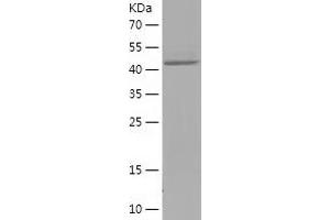 Western Blotting (WB) image for PSMC3 Interacting Protein (PSMC3IP) (AA 21-217) protein (His-IF2DI Tag) (ABIN7124703)