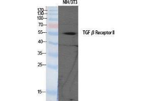 Western Blotting (WB) image for anti-Transforming Growth Factor, beta Receptor II (70/80kDa) (TGFBR2) (Tyr159) antibody (ABIN3187247) (TGFBR2 anticorps  (Tyr159))