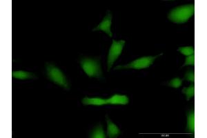 Immunofluorescence of purified MaxPab antibody to CCND1 on HeLa cell. (Cyclin D1 anticorps  (AA 1-295))
