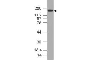 Image no. 1 for anti-Topoisomerase (DNA) II alpha 170kDa (TOP2A) (AA 1350-1529) antibody (ABIN5027581)