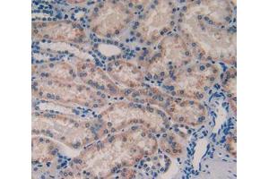 Used in DAB staining on fromalin fixed paraffin- embedded tissue