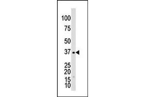 The anti-GALK1 Pab (ABIN391114 and ABIN2841244) is used in Western blot to detect GALK1 in Y79 cell lysate.