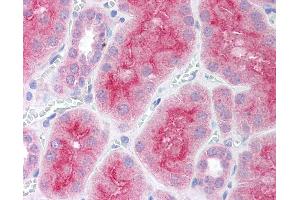 Anti-PARP2 antibody IHC of human kidney.