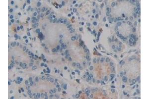 Detection of IL12A in Human Stomach Tissue using Monoclonal Antibody to Interleukin 12A (IL12A) (IL12A anticorps  (AA 23-219))