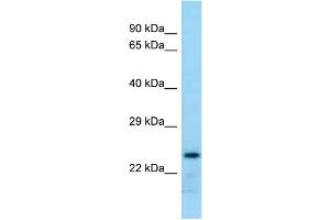 WB Suggested Anti-Rab17 Antibody Titration: 1. (RAB17 anticorps  (Middle Region))