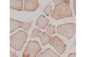 IHC-P analysis of Rat Tissue, with DAB staining. (TNNT1 anticorps  (AA 1-228))